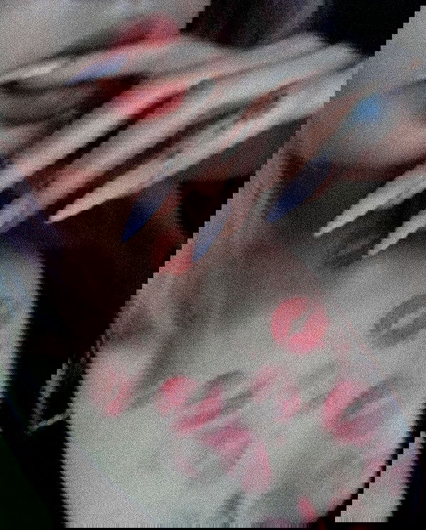 ratskeleton ratskeleton archive image