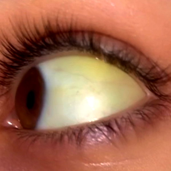 supersick3 instagram image archive image