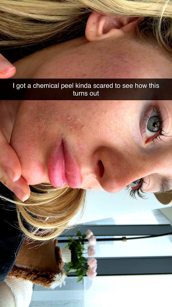 abbyy.irl image ~ Altpins