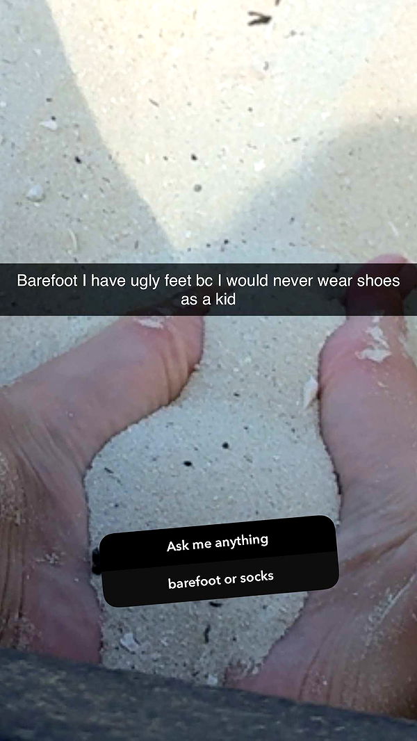 abbyy.irl image ~ Altpins