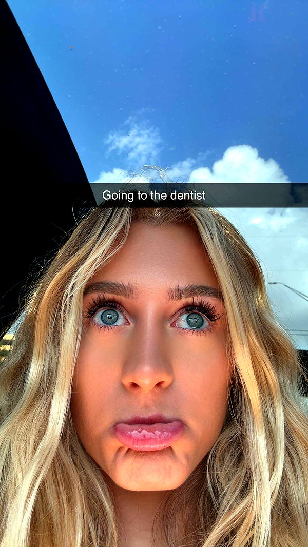 abbyy.irl image ~ Altpins