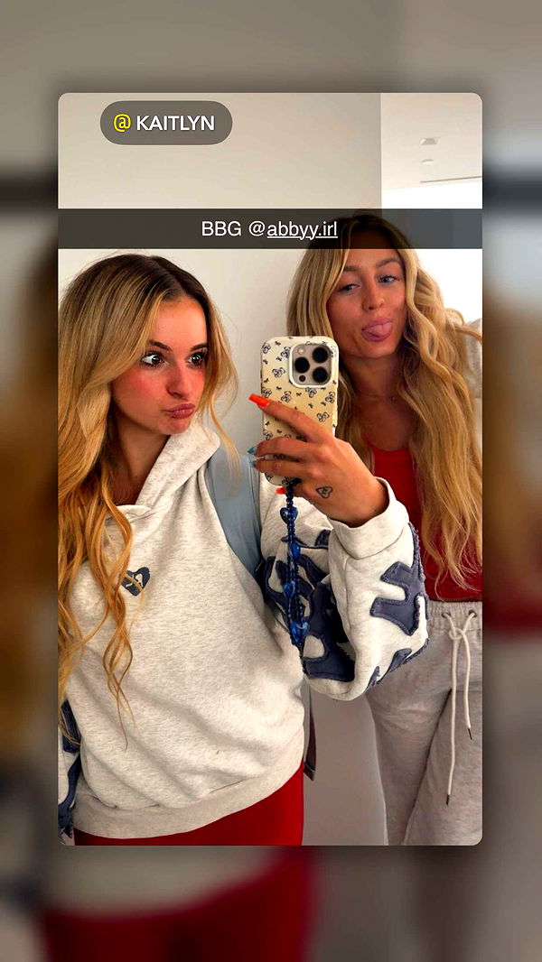 abbyy.irl image ~ Altpins