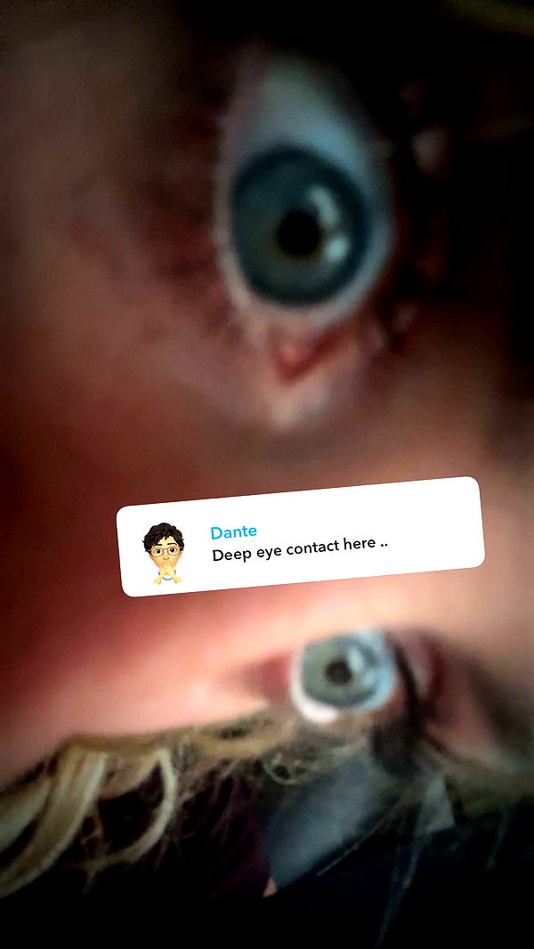 abbyy.irl image ~ Altpins