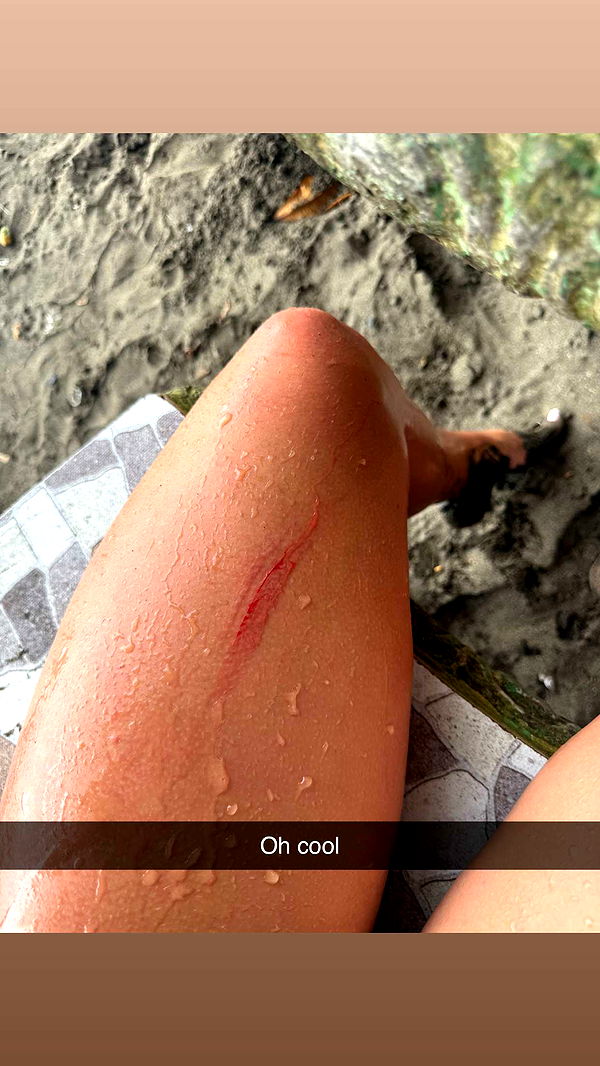 abbyy.irl image ~ Altpins