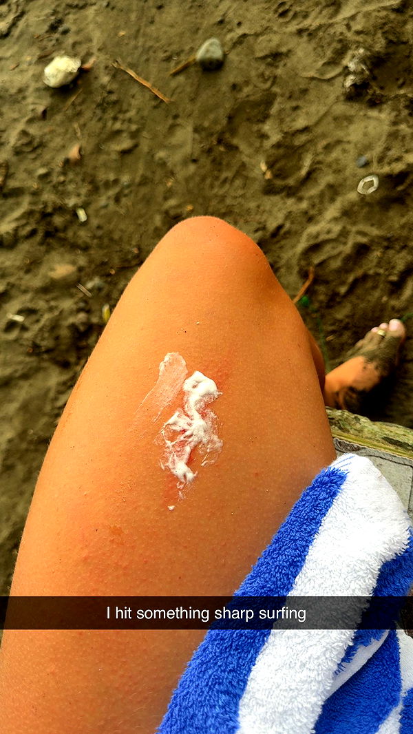 abbyy.irl image ~ Altpins