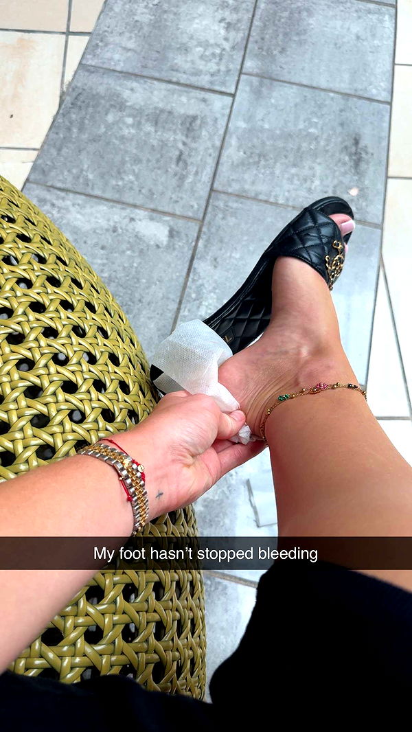 abbyy.irl image ~ Altpins