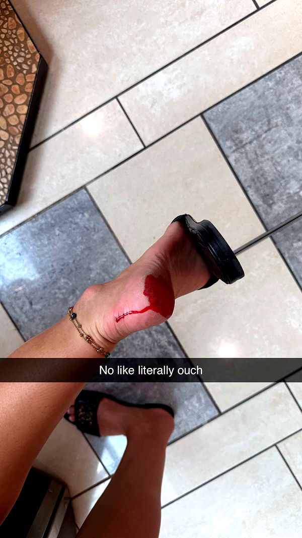 abbyy.irl image ~ Altpins