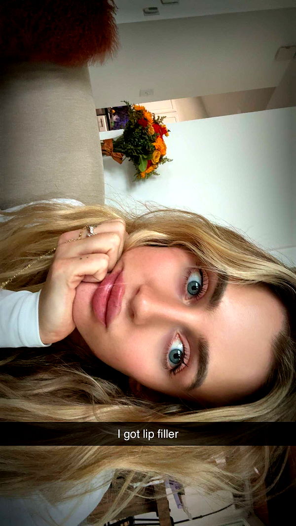 abbyy.irl image ~ Altpins