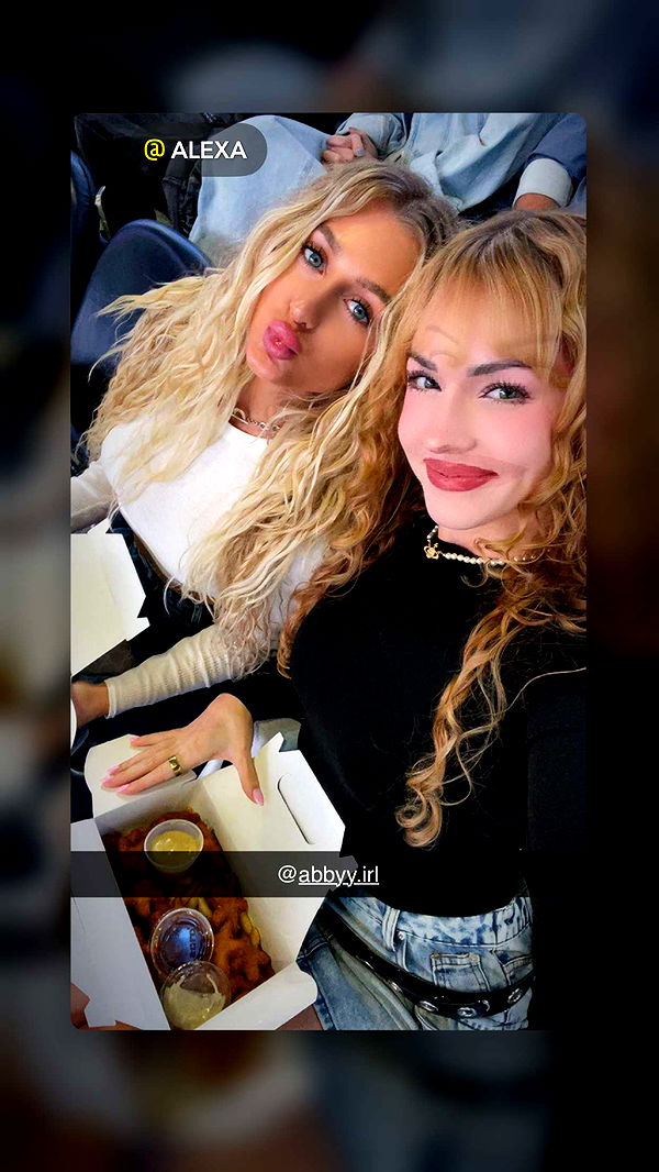 abbyy.irl image ~ Altpins