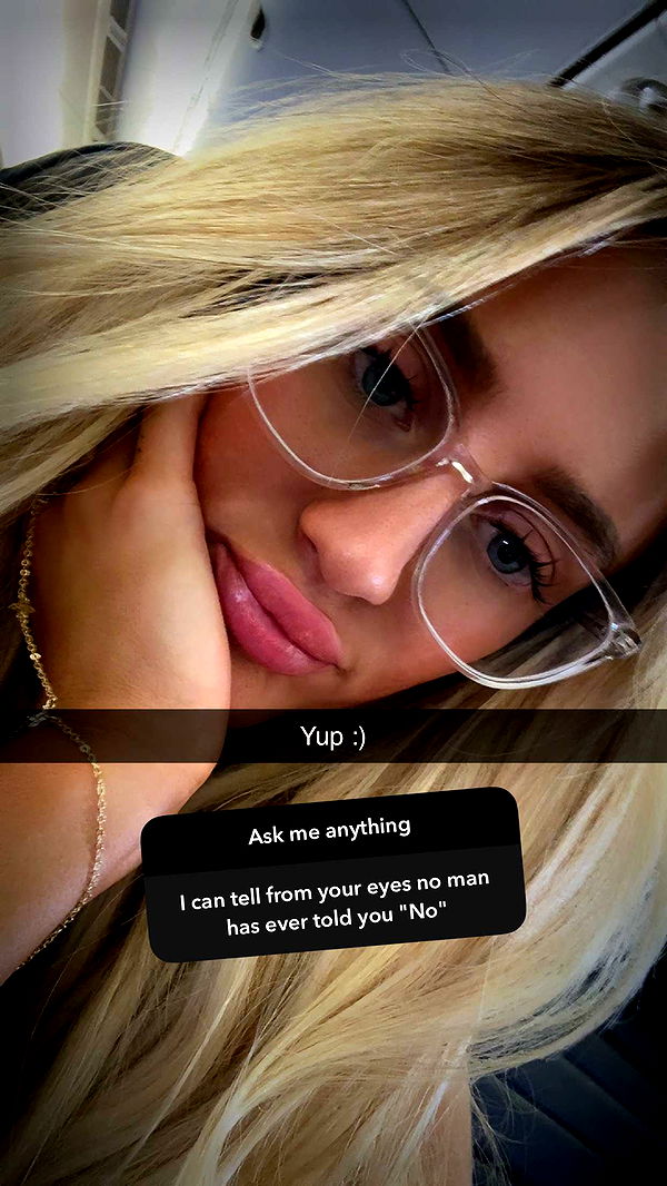 abbyy.irl image ~ Altpins