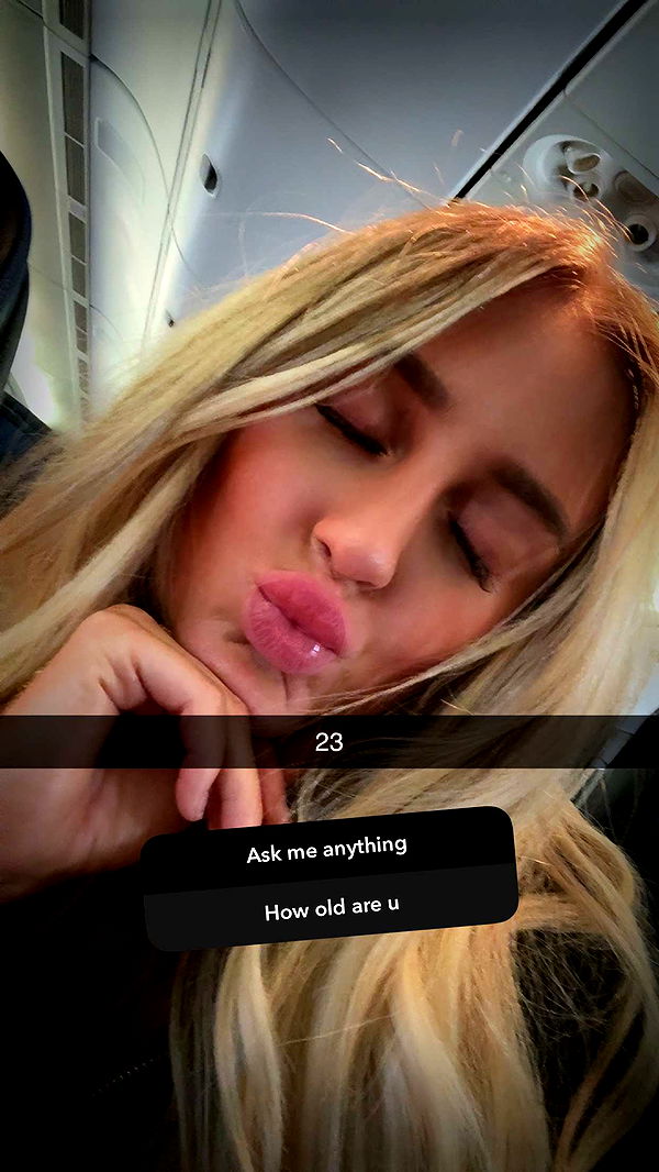 abbyy.irl image ~ Altpins