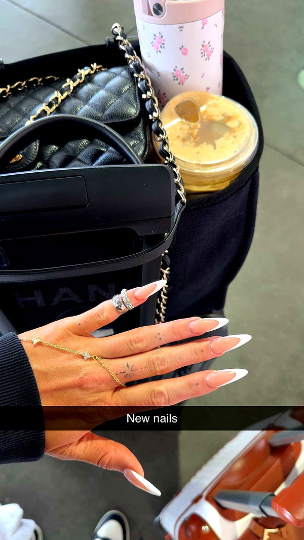 abbyy.irl image ~ Altpins