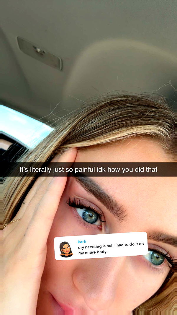 abbyy.irl image ~ Altpins