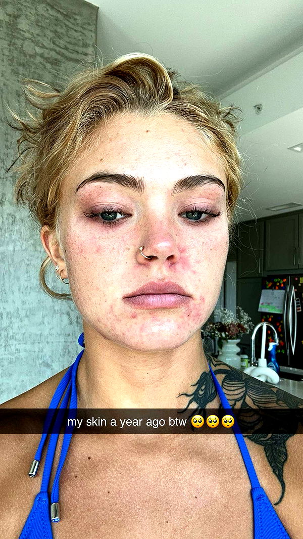 abigailwhhitee image ~ Altpins