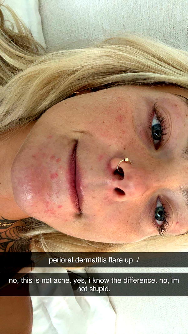 abigailwhhitee image ~ Altpins