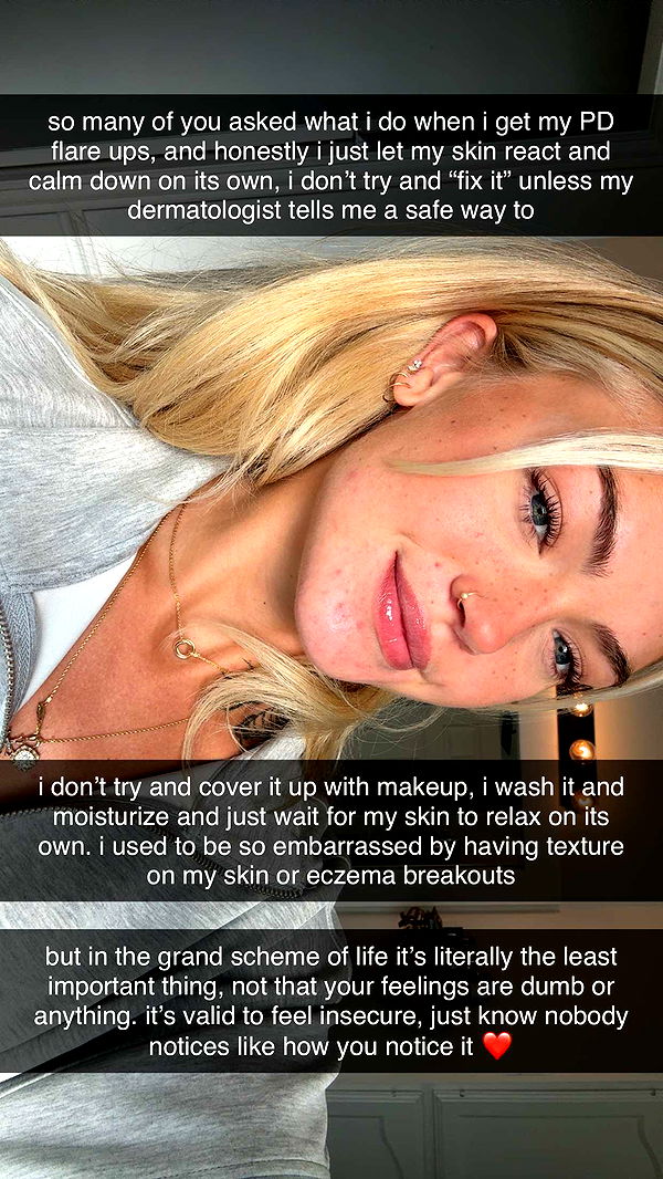 abigailwhhitee image ~ Altpins