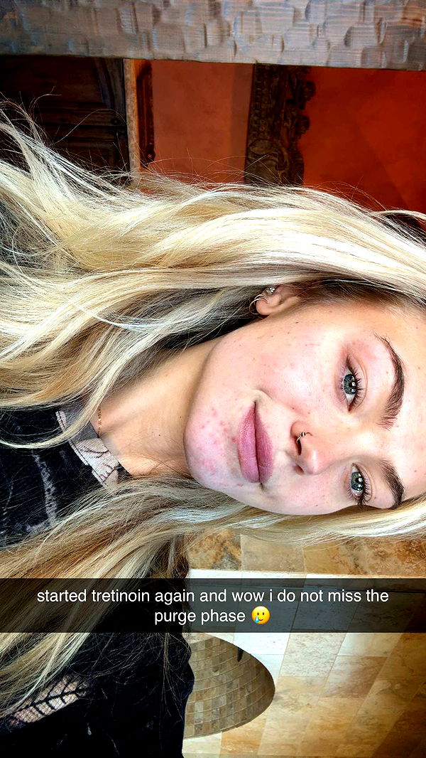 abigailwhhitee image ~ Altpins