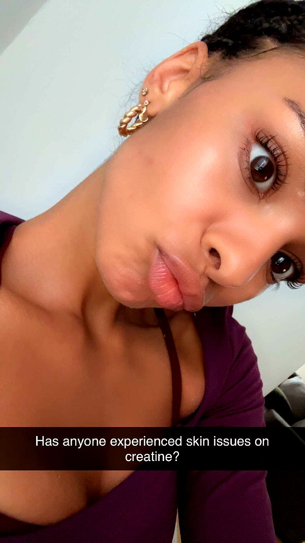 ally1renee image ~ Altpins