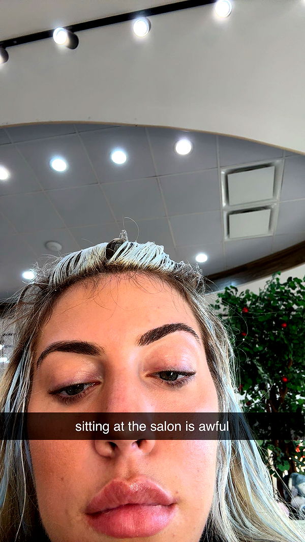 bellarenaldii image ~ Altpins