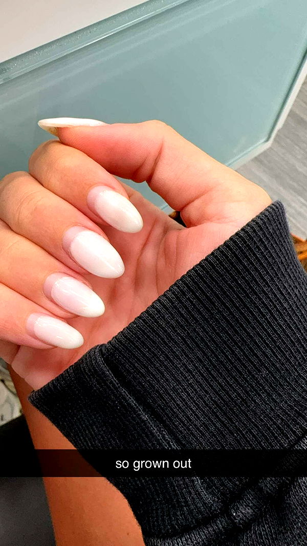 bellarenaldii image ~ Altpins