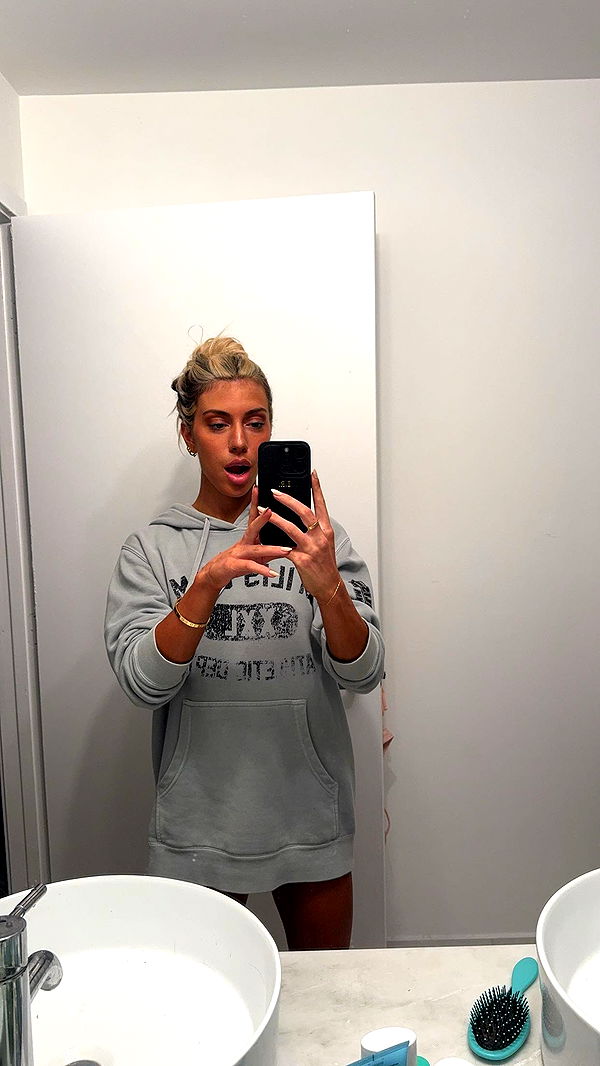 bellarenaldii image ~ Altpins