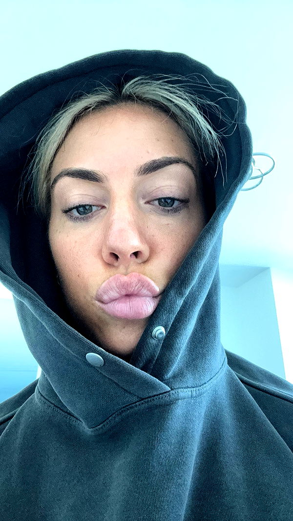 bellarenaldii image ~ Altpins