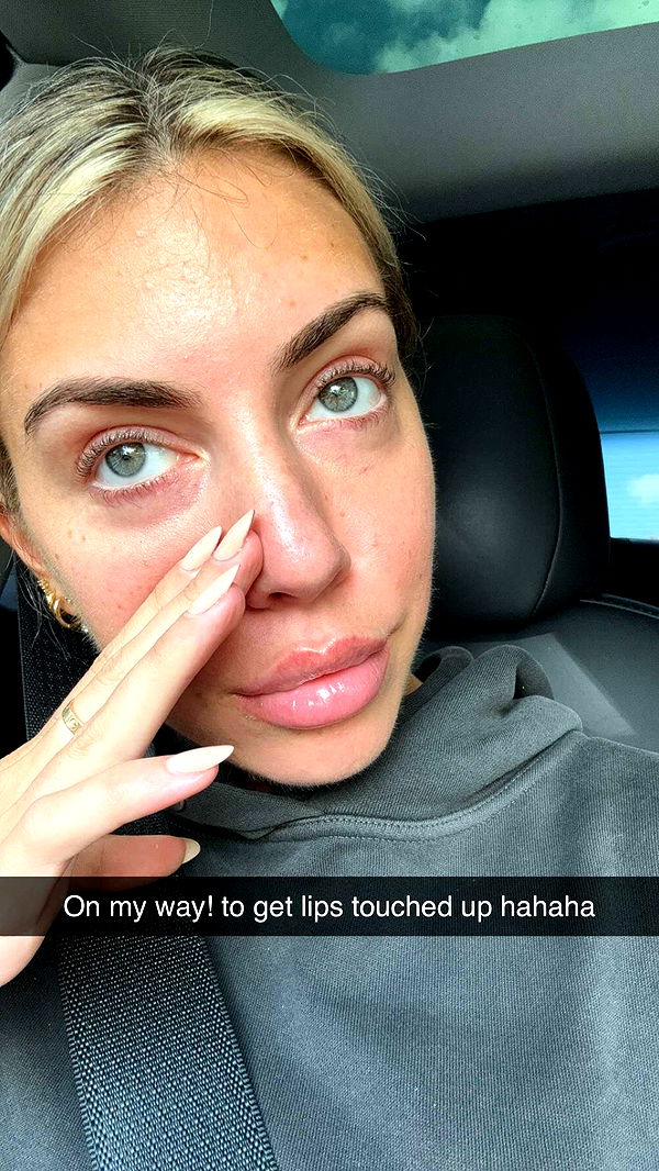 bellarenaldii image ~ Altpins