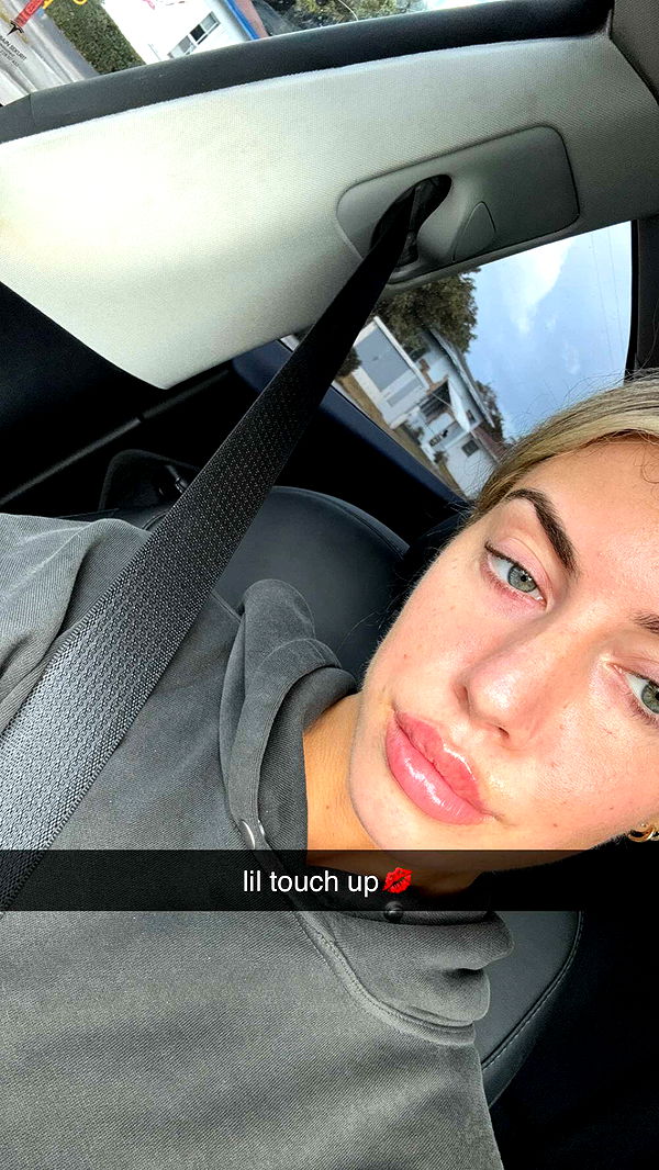 bellarenaldii image ~ Altpins