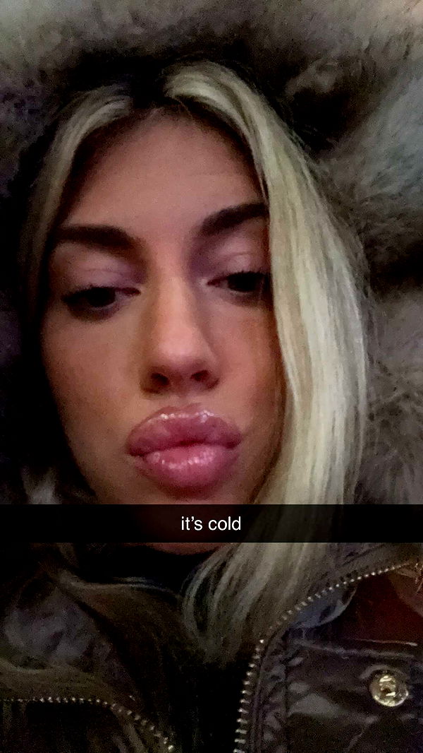 bellarenaldii image ~ Altpins