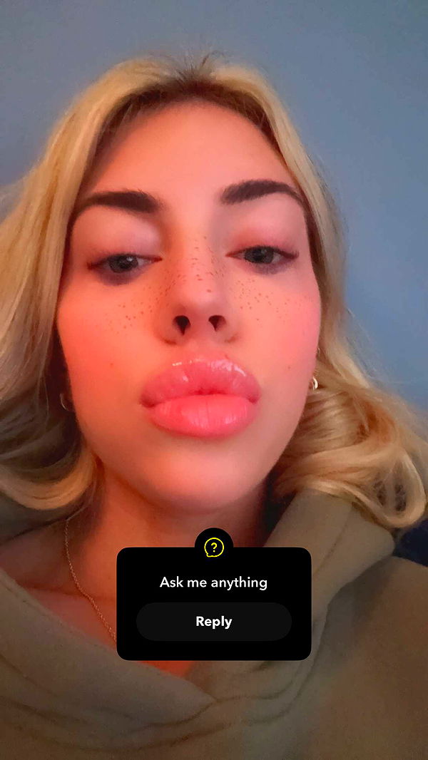 bellarenaldii image ~ Altpins