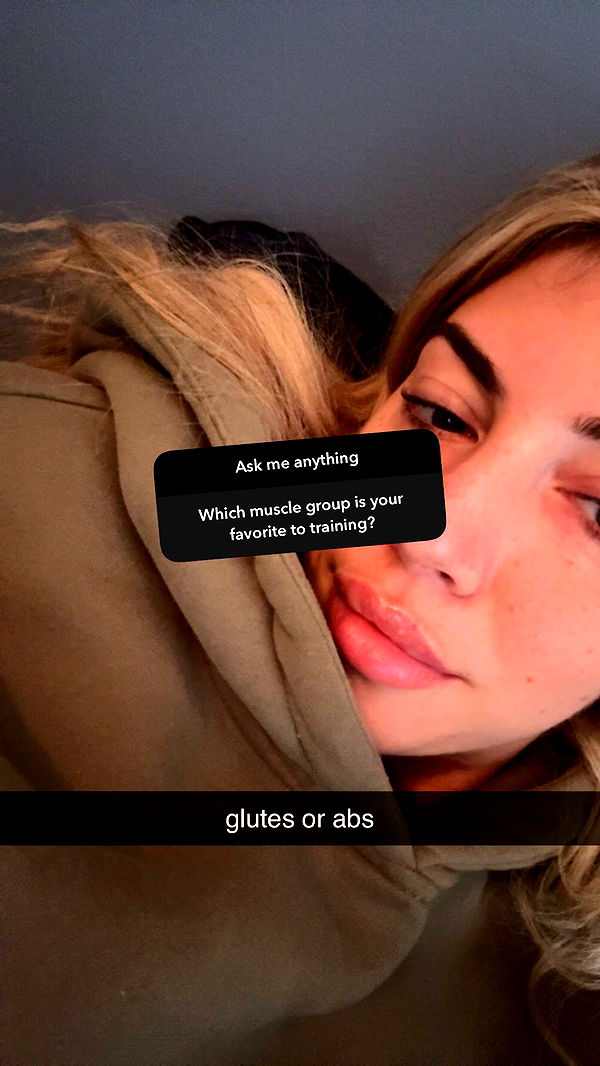 bellarenaldii image ~ Altpins