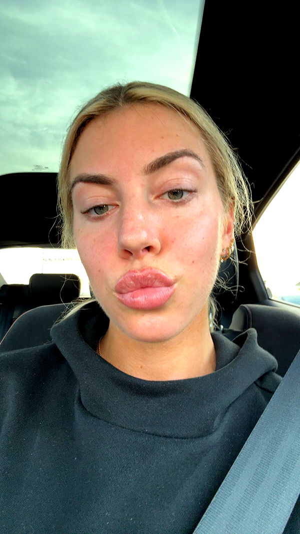 bellarenaldii image ~ Altpins