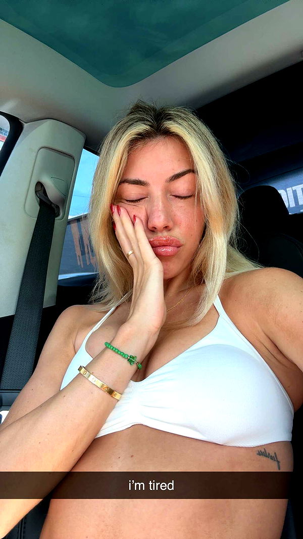 bellarenaldii image ~ Altpins