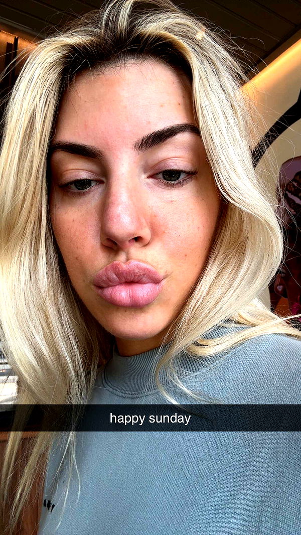 bellarenaldii image ~ Altpins