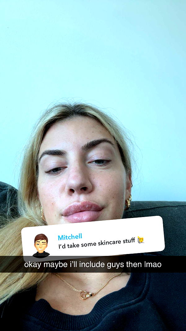 bellarenaldii image ~ Altpins