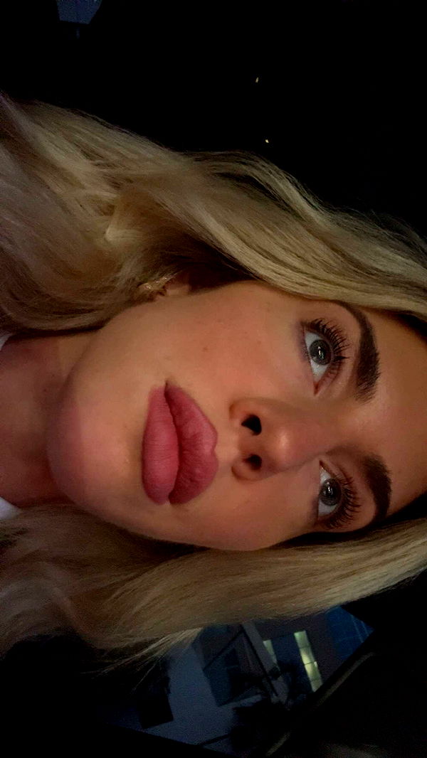 bellarenaldii image ~ Altpins