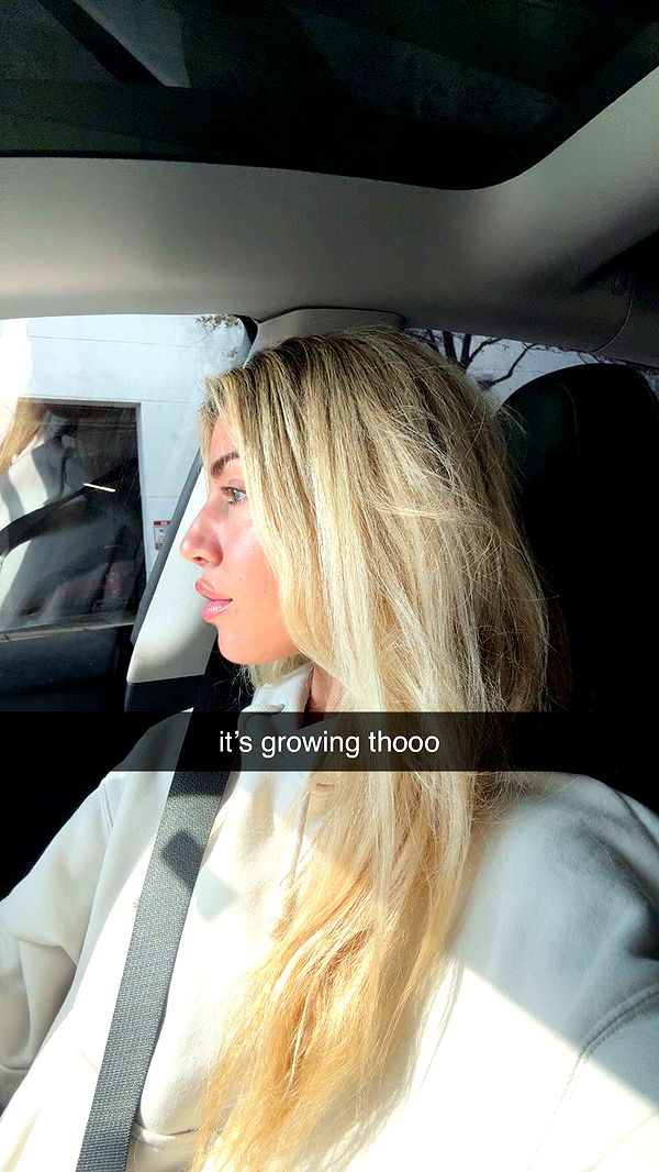 bellarenaldii image ~ Altpins