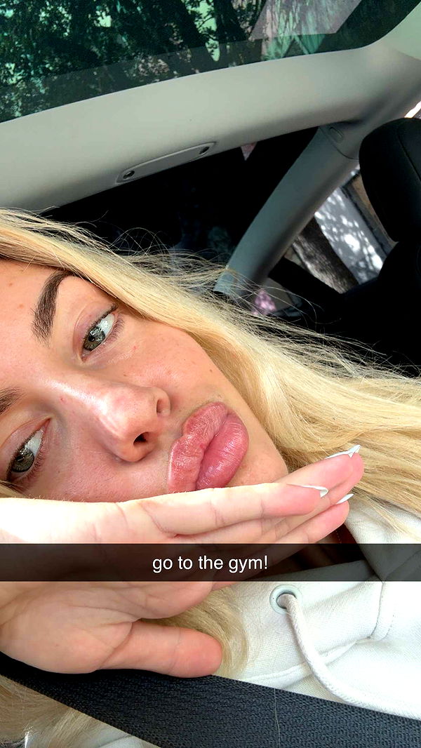 bellarenaldii image ~ Altpins