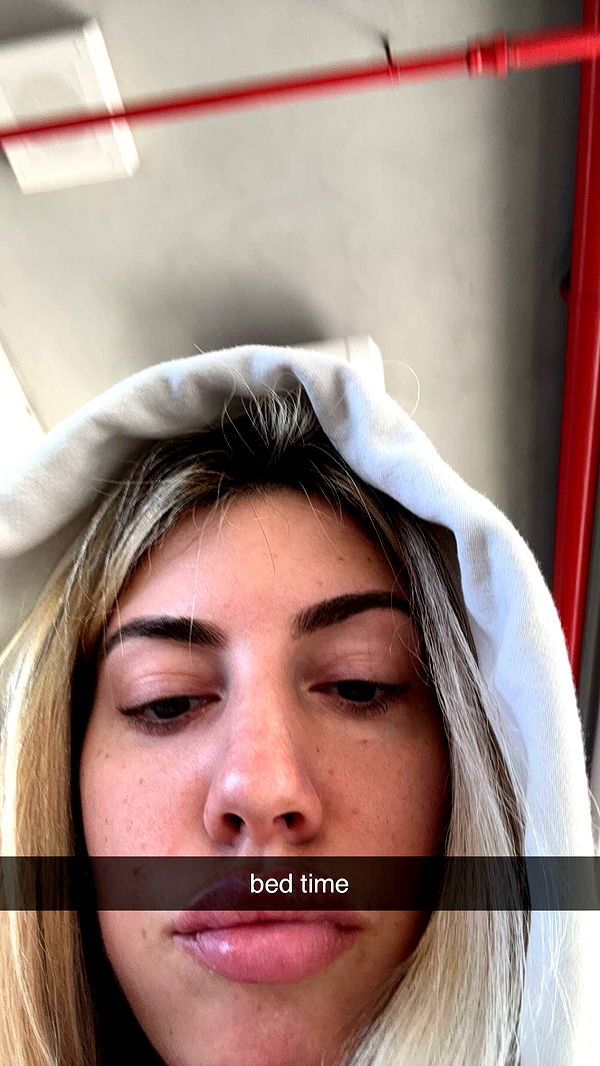 bellarenaldii image ~ Altpins