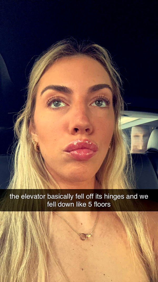 bellarenaldii image ~ Altpins