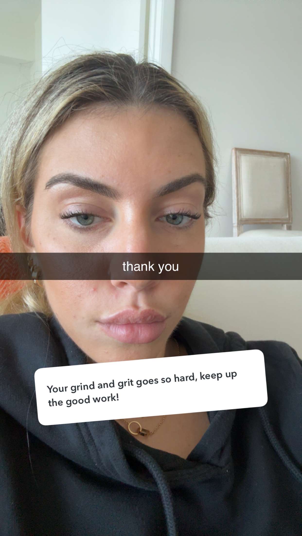 bellarenaldii snapchat image archive image