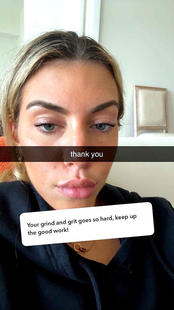 bellarenaldii image ~ Altpins