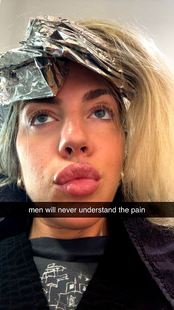 bellarenaldii image ~ Altpins