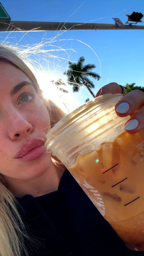 bellarenaldii image ~ Altpins