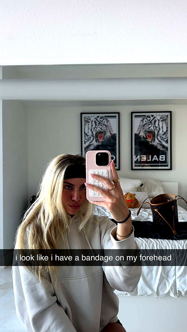 bellarenaldii image ~ Altpins