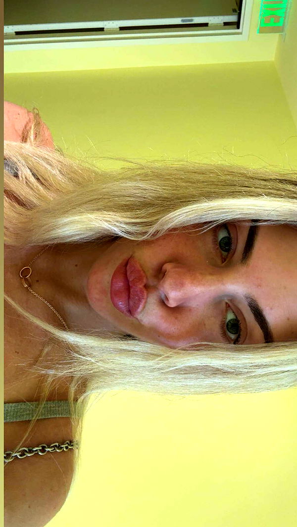 bellarenaldii image ~ Altpins