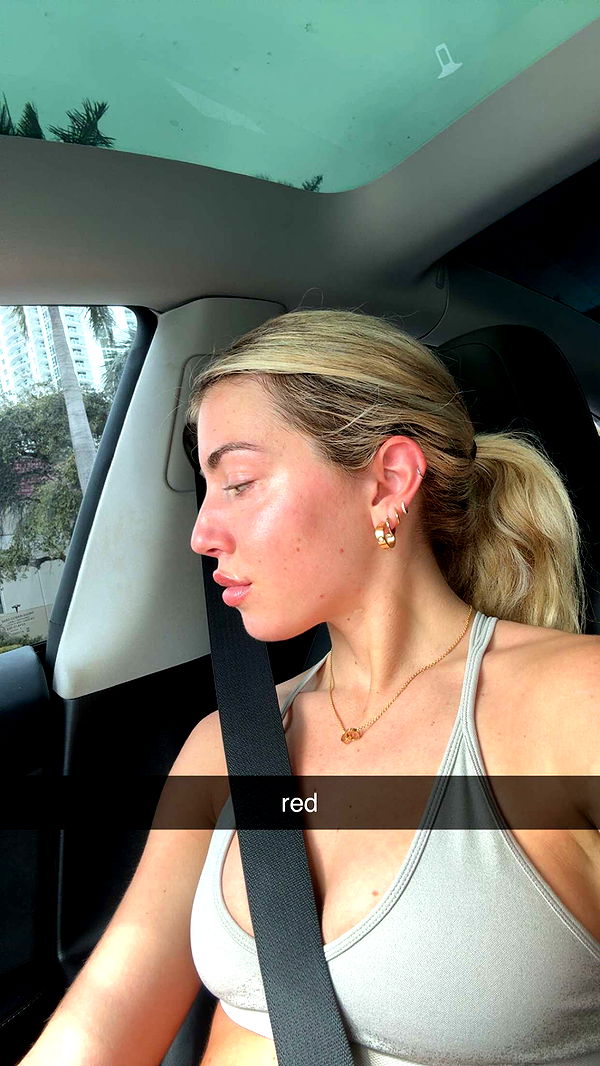 bellarenaldii image ~ Altpins