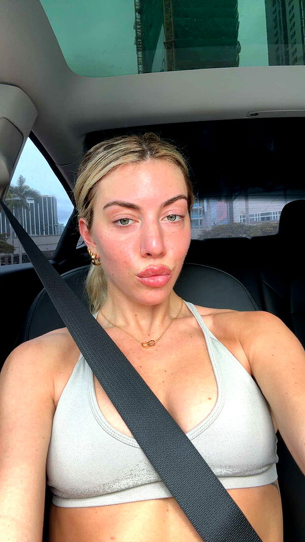 bellarenaldii image ~ Altpins