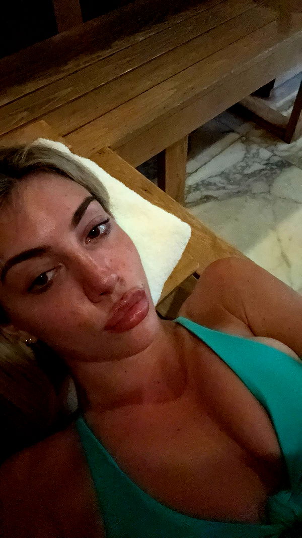 bellarenaldii image ~ Altpins