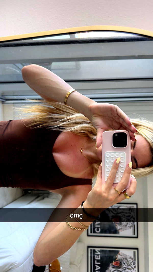 bellarenaldii image ~ Altpins